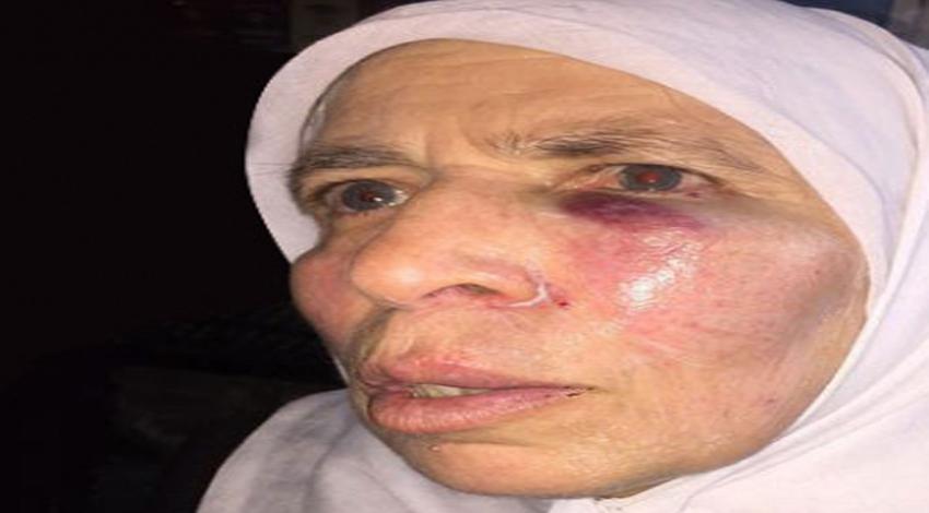 Gözü dönmüşlerden yaşlı teyzeye 'Evet' dayağı!