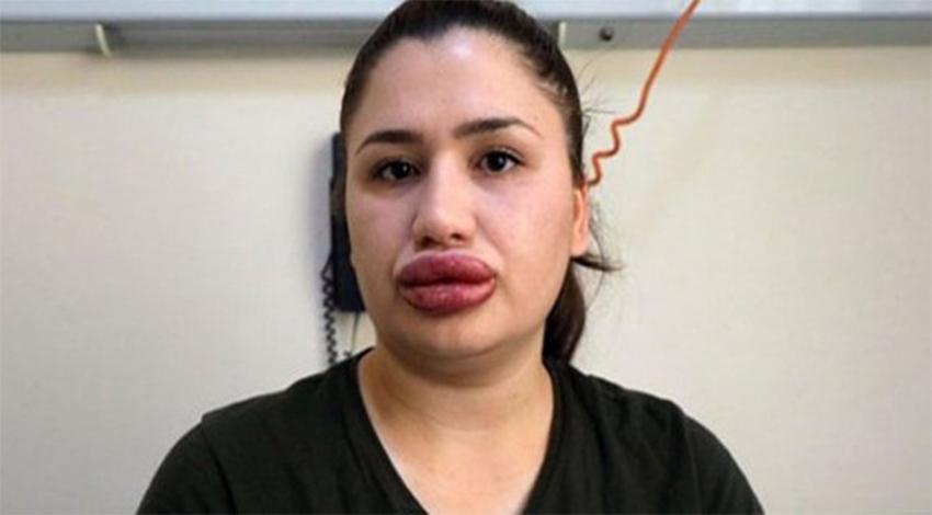 Sağlık Bakanlığı o konuya el attı!