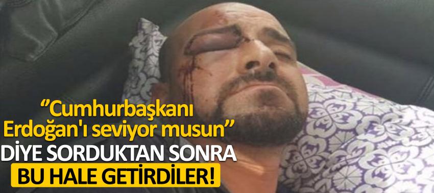Belçika'da bir Türk vatandaşı Irkçılar tarafından feci şekilde dövüldü