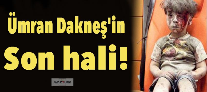 İşte Ümran Dakneş'in son hali!