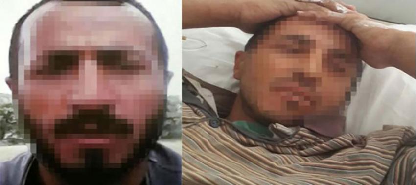 Domuz sanıp vurdukları adam bakın kim çıktı!