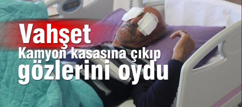 Uyuşturucu bağımlısı yaşlı adamın gözlerini oydu