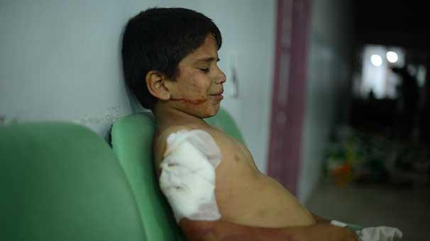 PKK, yine çocukları vurdu!