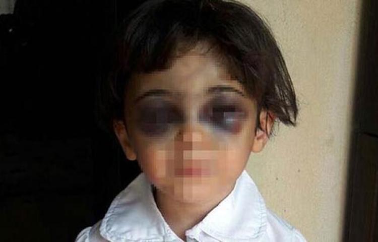 Üvey anne vahşeti pes dedirtti!