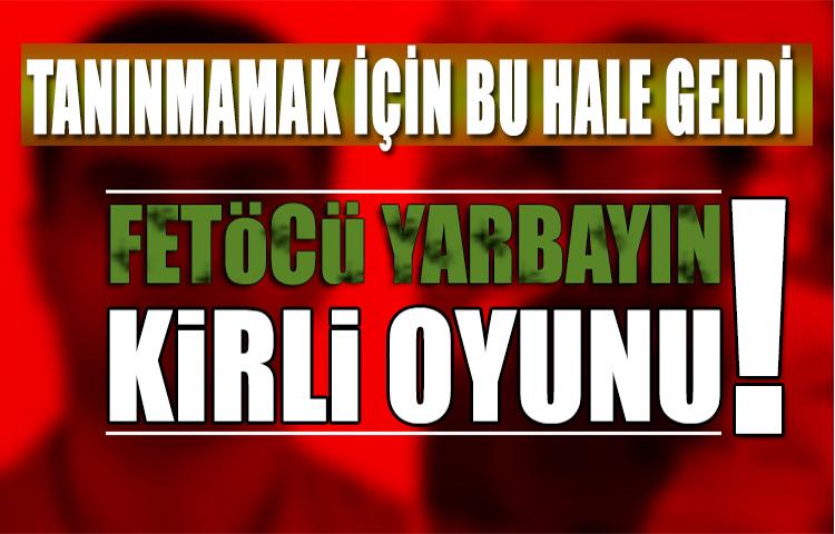 Tanınmamak için her şeyini değiştirmiş!