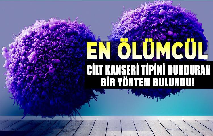 En ölümcül cilt kanseri tipini durduran bir yöntem bulundu
