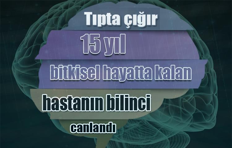 Tıpta çığır: 15 yıl bitkisel hayatta kalan hastanın bilinci canlandı