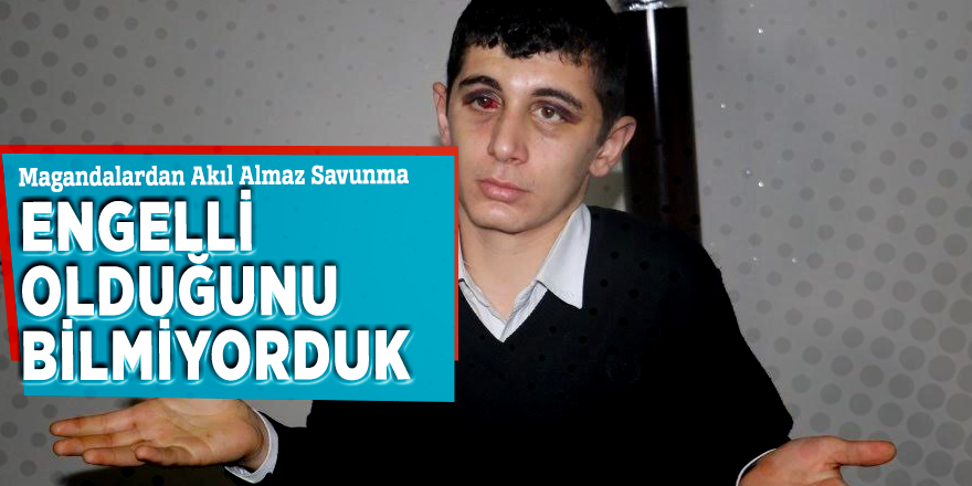 Magandalardan Akıl Almaz Savunma