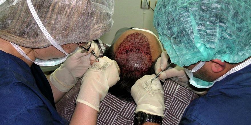 Japon bilim insanlarından 'kellik sorununa' çözüm