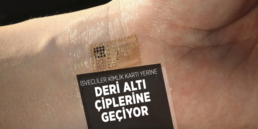 İsveçliler kimlik kartı yerine deri altı çiplerine geçiyor