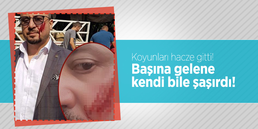 Koyunları hacze gitti! Başına gelene kendi bile şaşırdı!