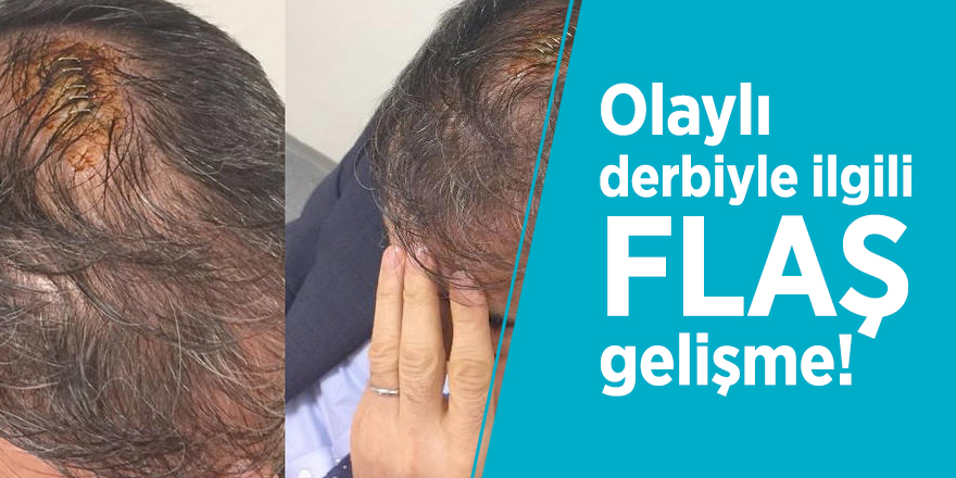 Olaylı derbiyle ilgili flaş gelişme!