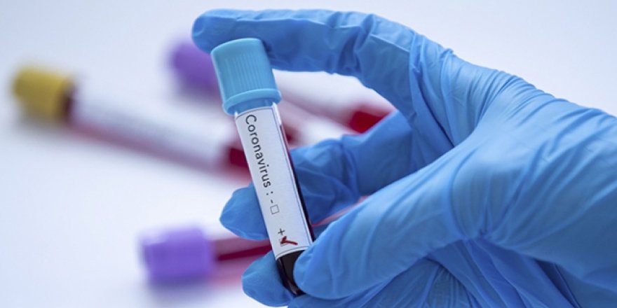 ABD'de son 24 saatte 43 bin yeni vaka tespit edildi!