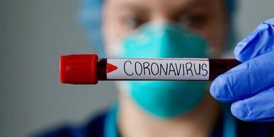 Dünya genelinde 76 milyon fazla kişi Kovid-19'a yakalandı