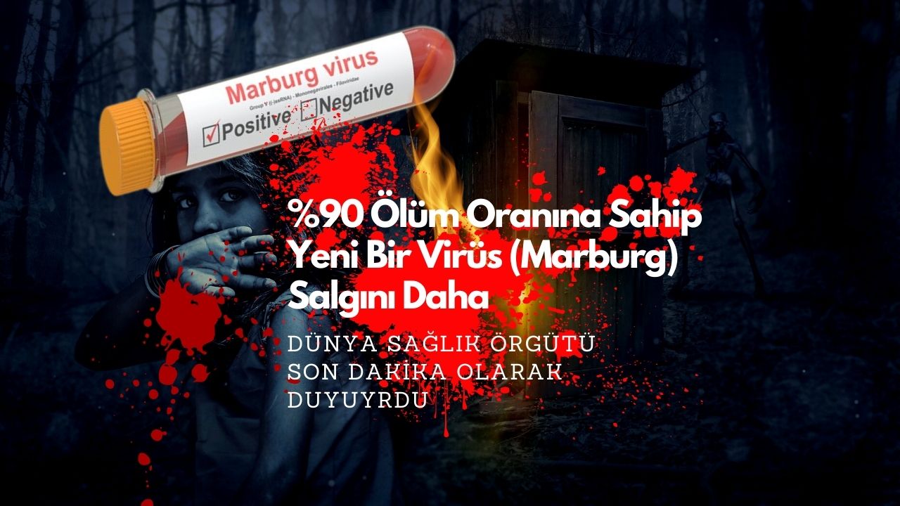 Yüzde 90 ölüm oranına sahip Marburg virüsü hızla yayılmaya başladı!