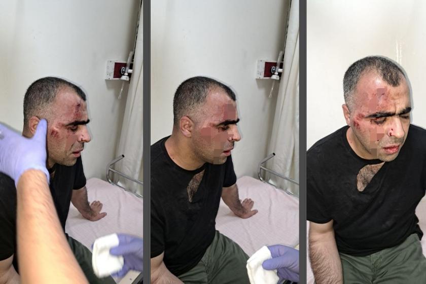 Sinan Aygül’e saldıran belediye başkanı koruması ve bir polis açığa alındı!