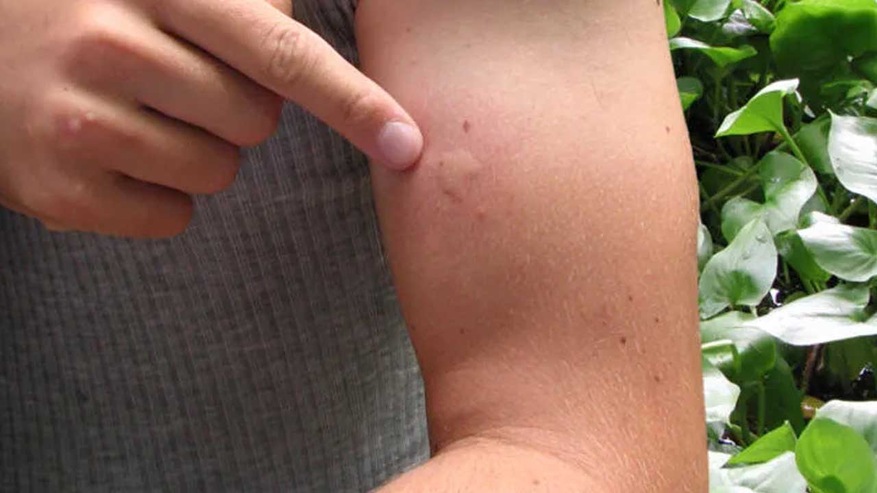 İzmirlilere sivrisinek uyarısı: Sakın bunu yapmayın!