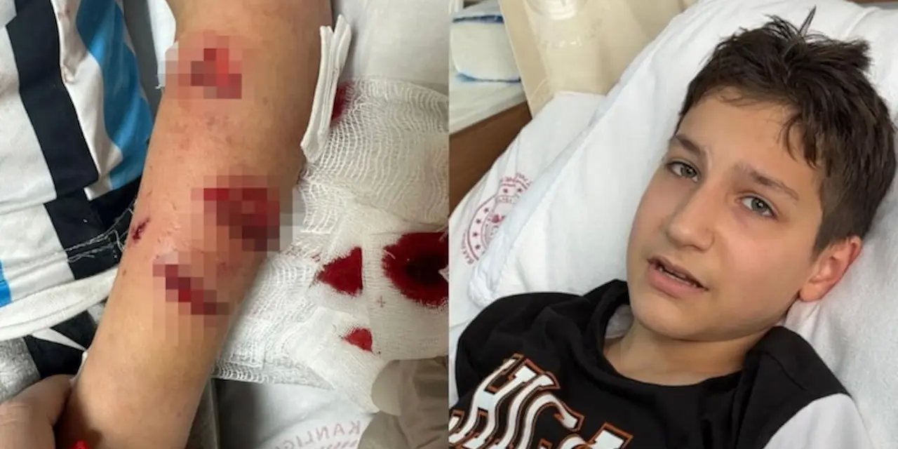 "Küçük Bir Yardım Girişimi Trajediye Dönüşüyor: Güneysu'da Başıboş Köpeğin Saldırısı