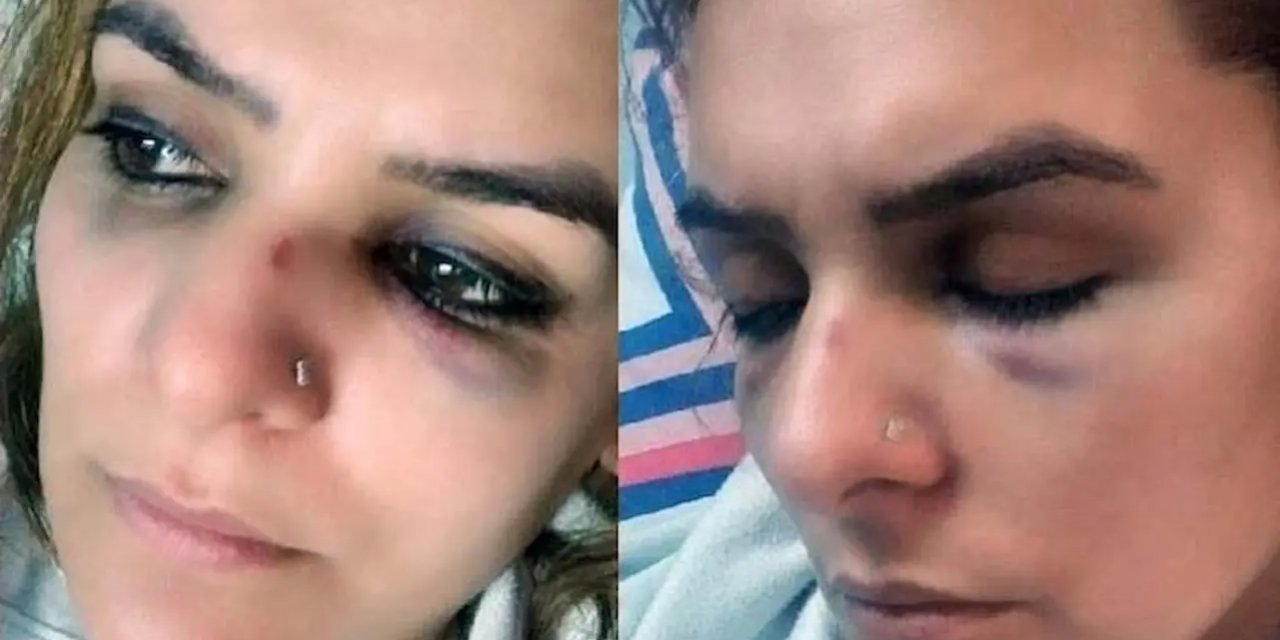 Roman Ailelerin 'Fahri Koordinatörü'ne Yönelik Şiddet