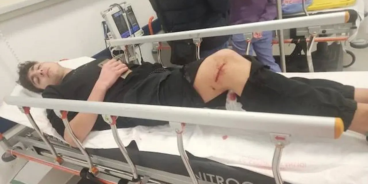 Ankara Çankaya'da Genç Öğrenciye Köpek Saldırısı: Öğretmenin Kahramanca Müdahalesi