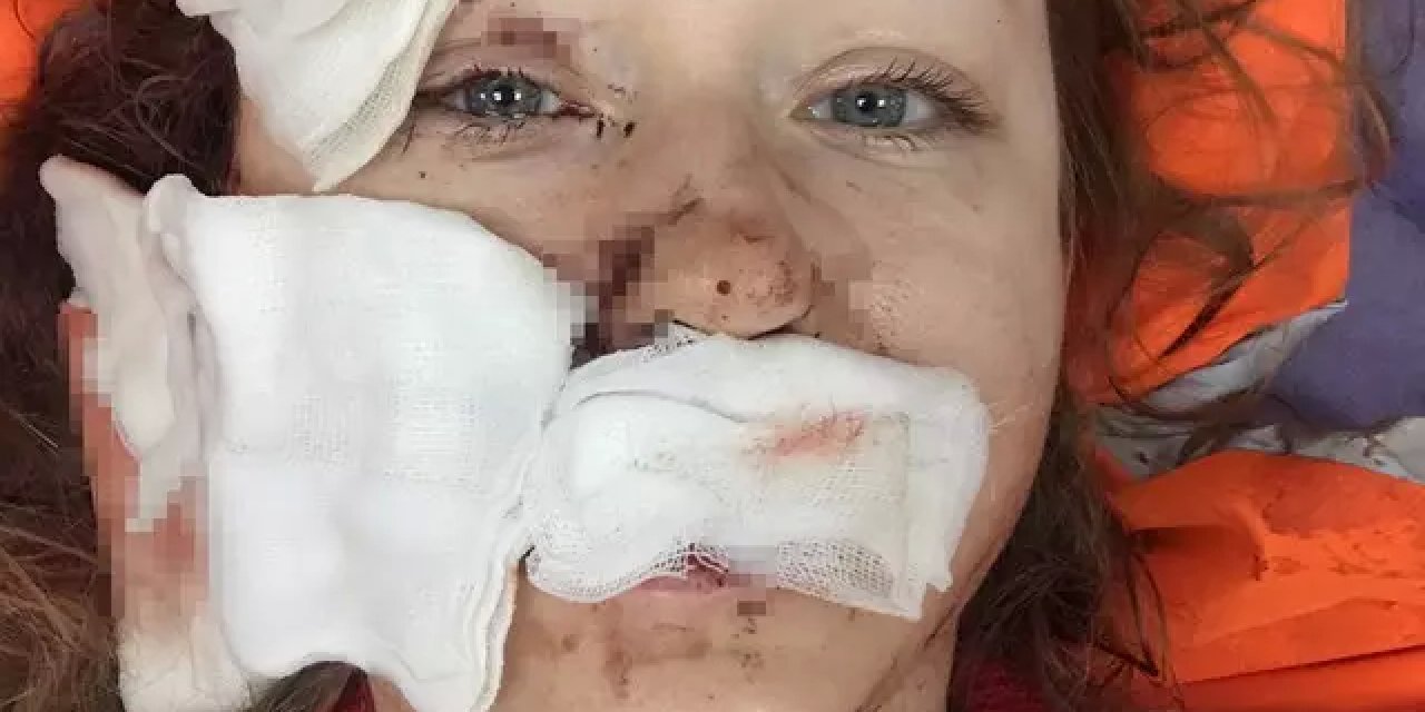 Alışveriş Merkezi Dehşeti: Eşini Falçatayla Yaralayan Koca, Şaşırtıcı Mahkeme Kararıyla Serbest!