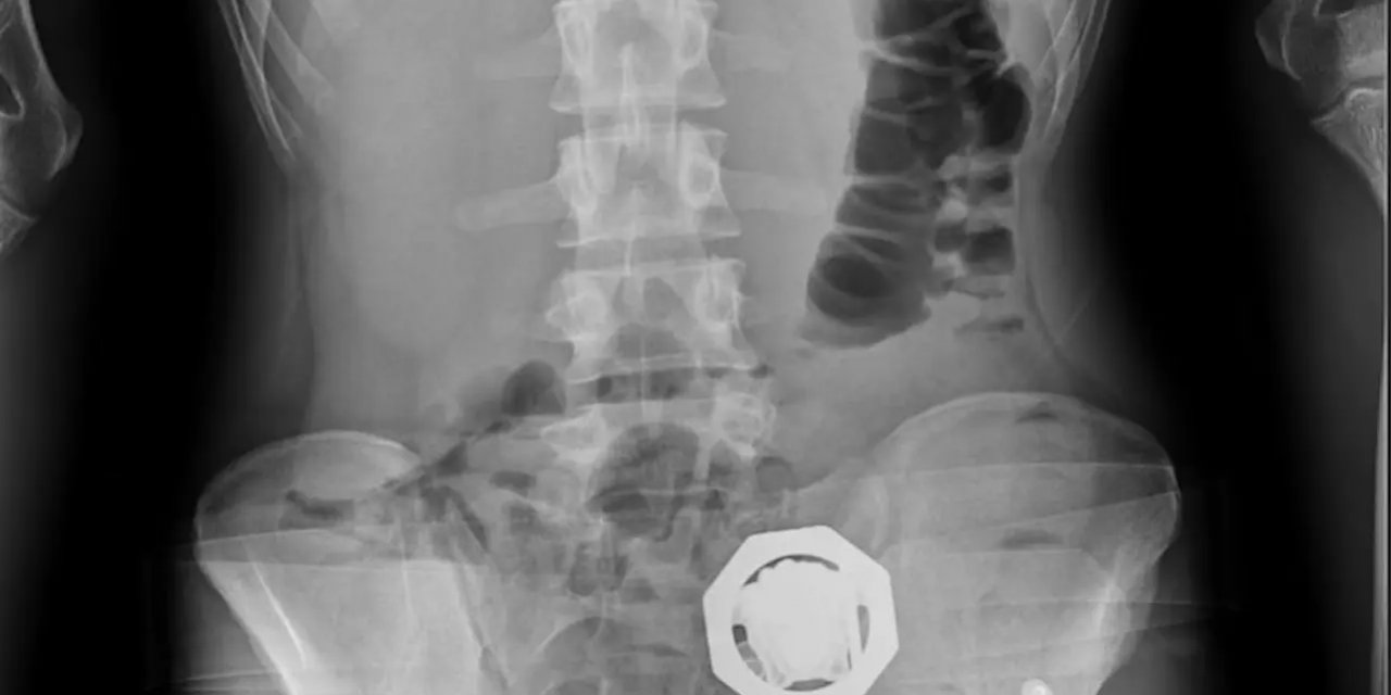 Diyarbakır’da Eroin Taşıyan 4 Şüpheli Tutuklandı: Operasyonun Perde Arkası