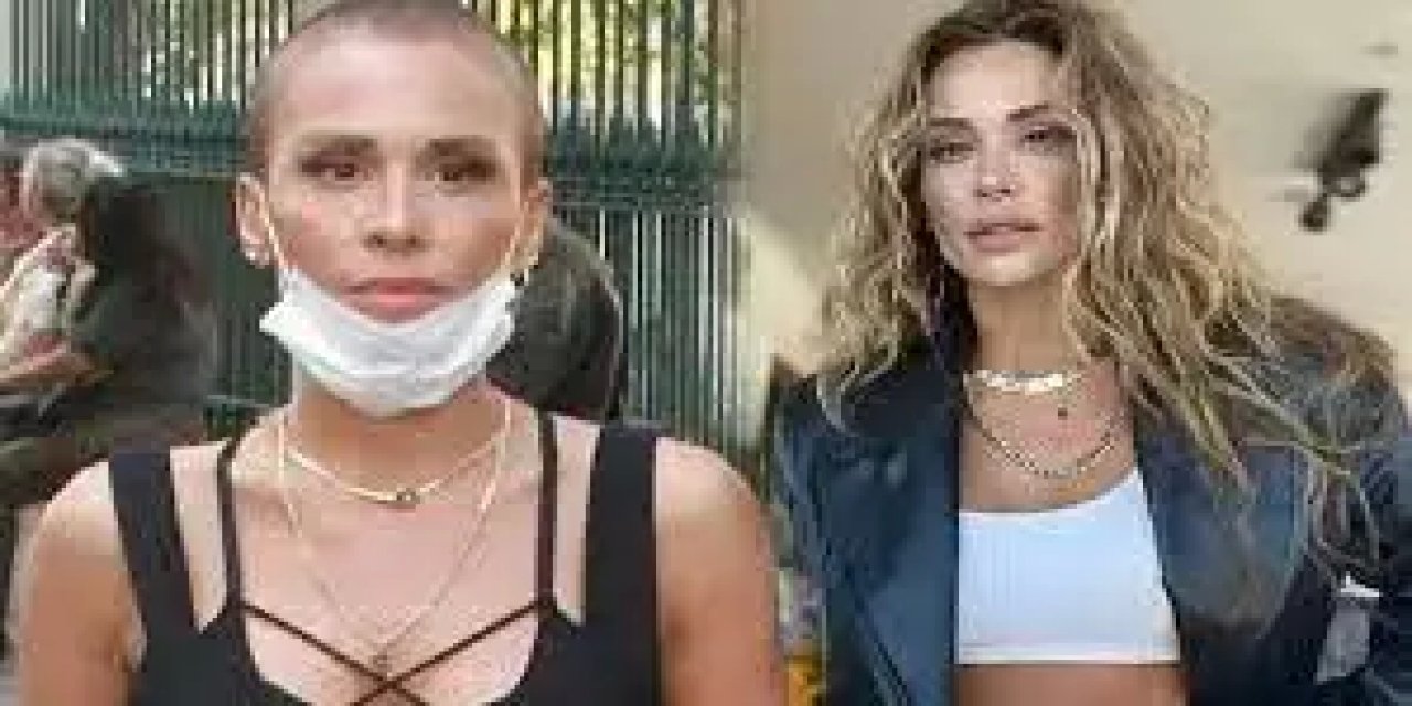 O Şarkıcıdan Kötü Haber Geldi! Tümör Görüldü!