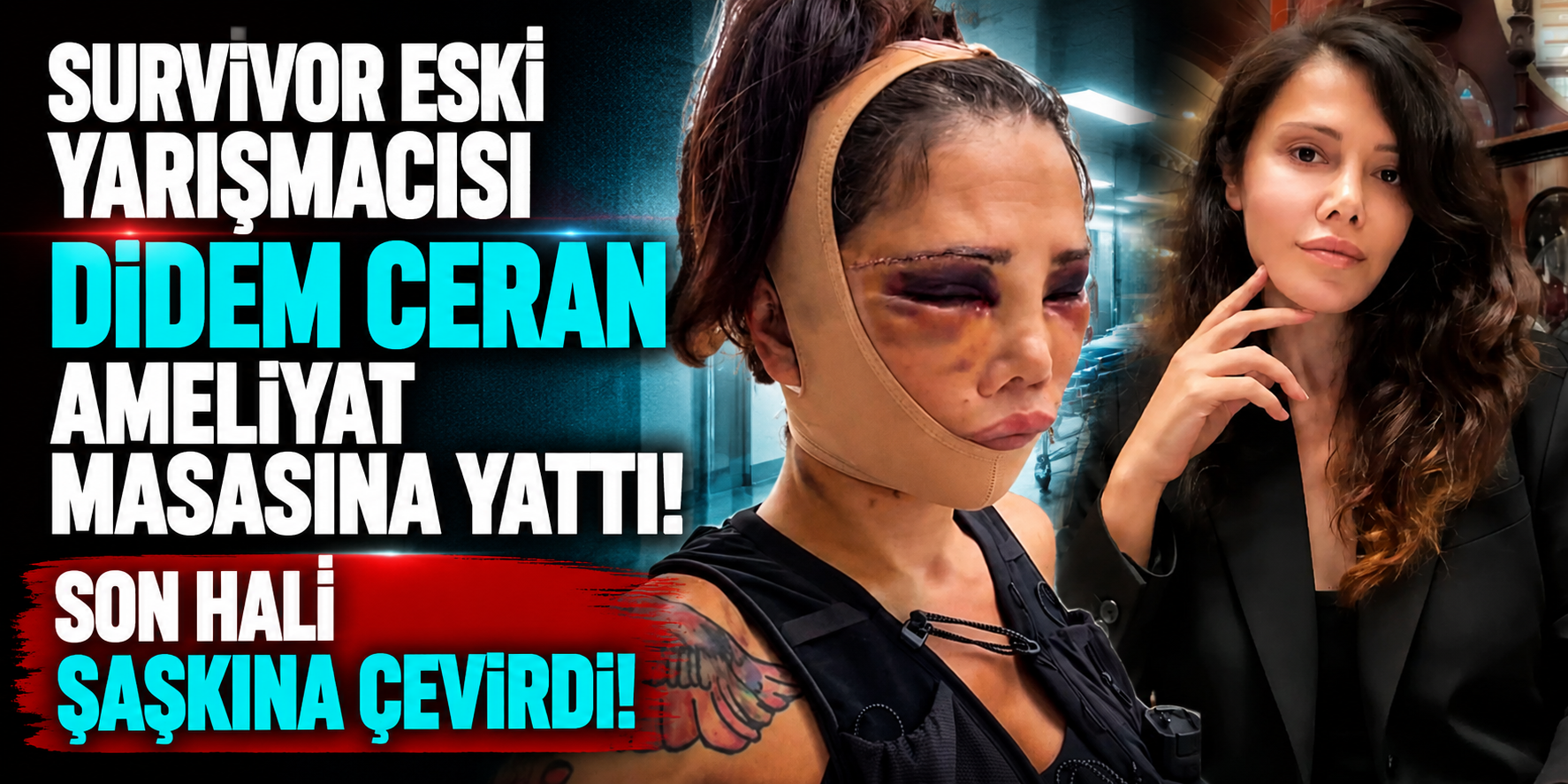 Survivor Eski Yarışmacısı Didem Ceran Ameliyat Masasına Yattı! Son Hali Şaşkına Çevirdi