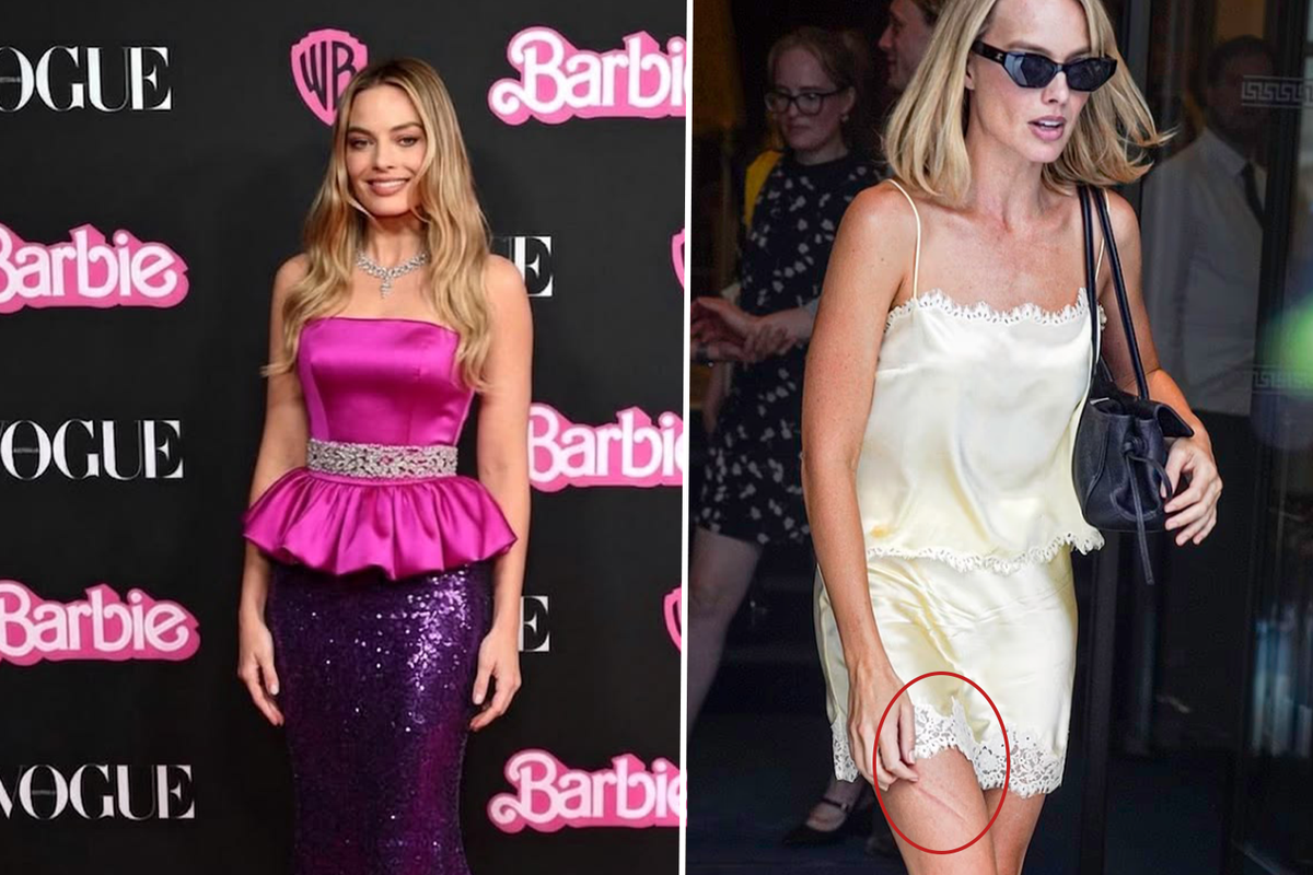 Mini Eteğinin Altından Çıkan Detay Olay Oldu: Hollywood Yıldızı Margot Robbie’ye Ne Oldu?