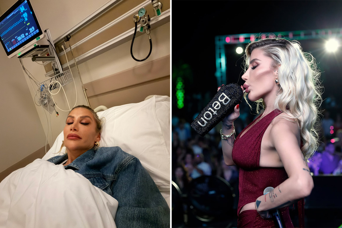 Çenesi Külah Gibi Şişti, Sosyal Medya Çalkalandı: İrem Derici’nin "Dolgu" Yalanlaması!