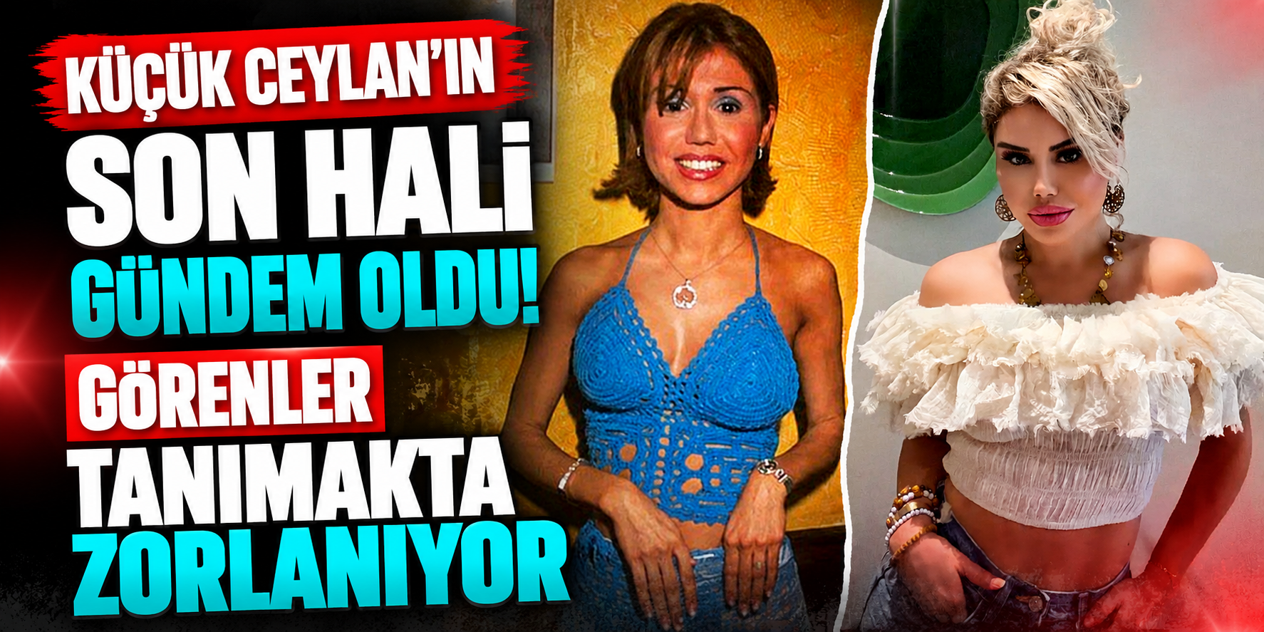 "Küçük Ceylan"ı Görünce Şok Olacaksınız: Yüz Hatları Ve İmajı Bambaşka Birine Dönüştü!