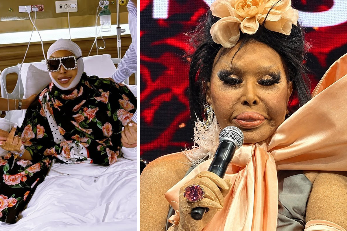 Bülent Ersoy’un “Lolita Estetiği” Sonrası Yeni Hali Ortaya Çıktı! “Bana Abla Demeyin”
