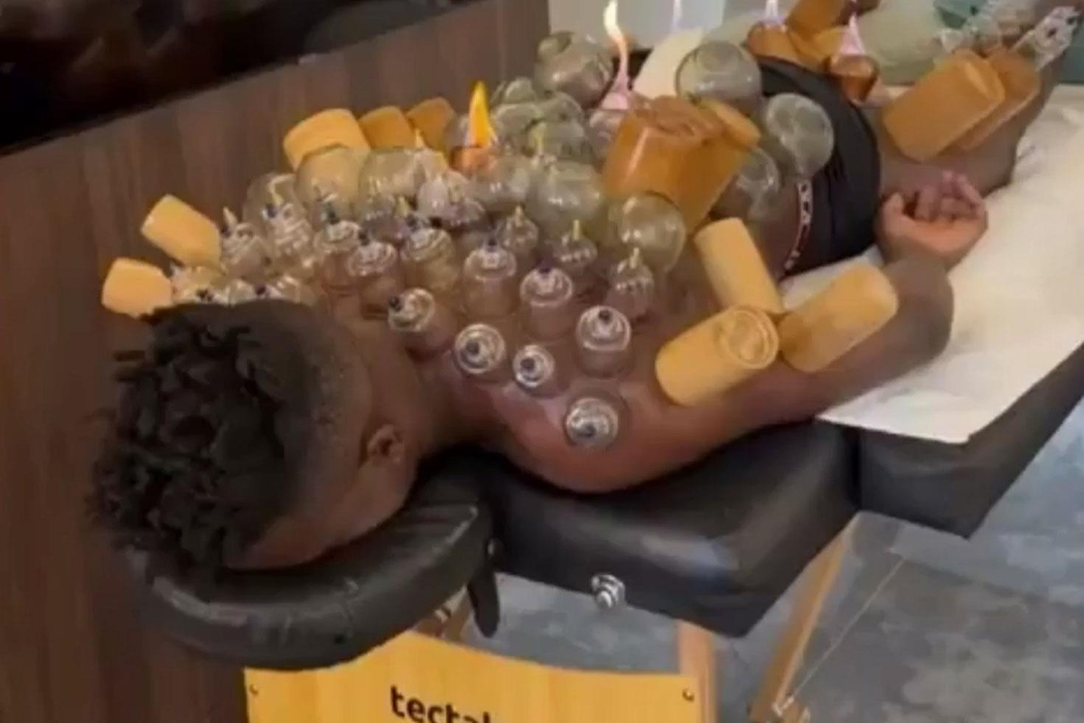 Andre Onana Bu Kez Sahada Değil! Hacamat Yaptırdığı Anları Paylaştı