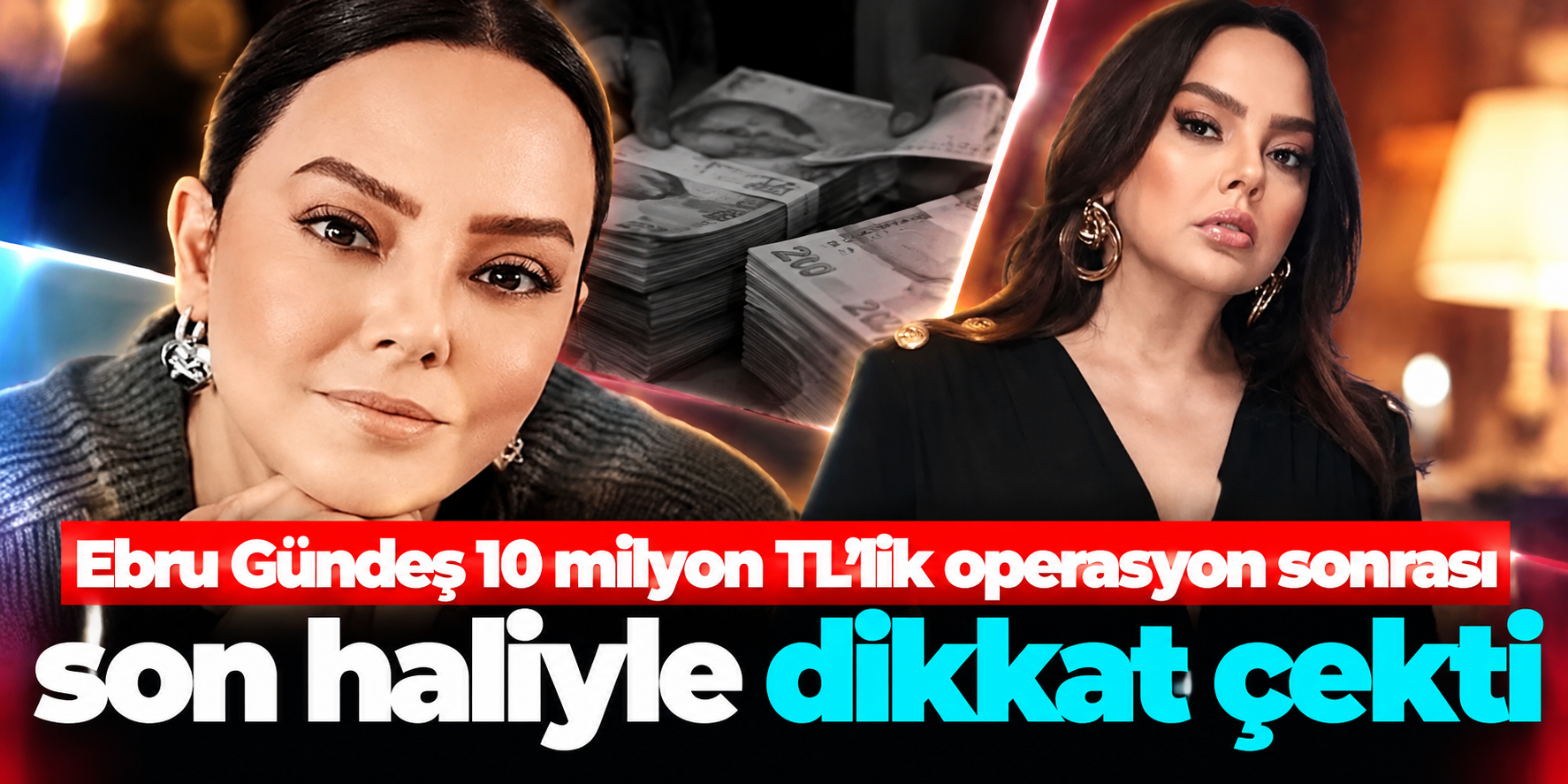 Ebru Gündeş’in Son Hâli Gündem Oldu: 10 Milyon TL’lik Operasyon Sonrası Değişimi Dikkat Çekti
